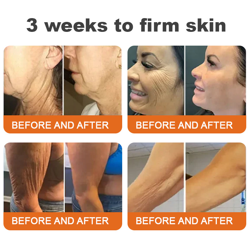 đđFlysmusâą Botox Bee Venom Firming Serum Stick â (Hergestellt und versendet in Germany) â LETZTER TAG 70 % RABATT