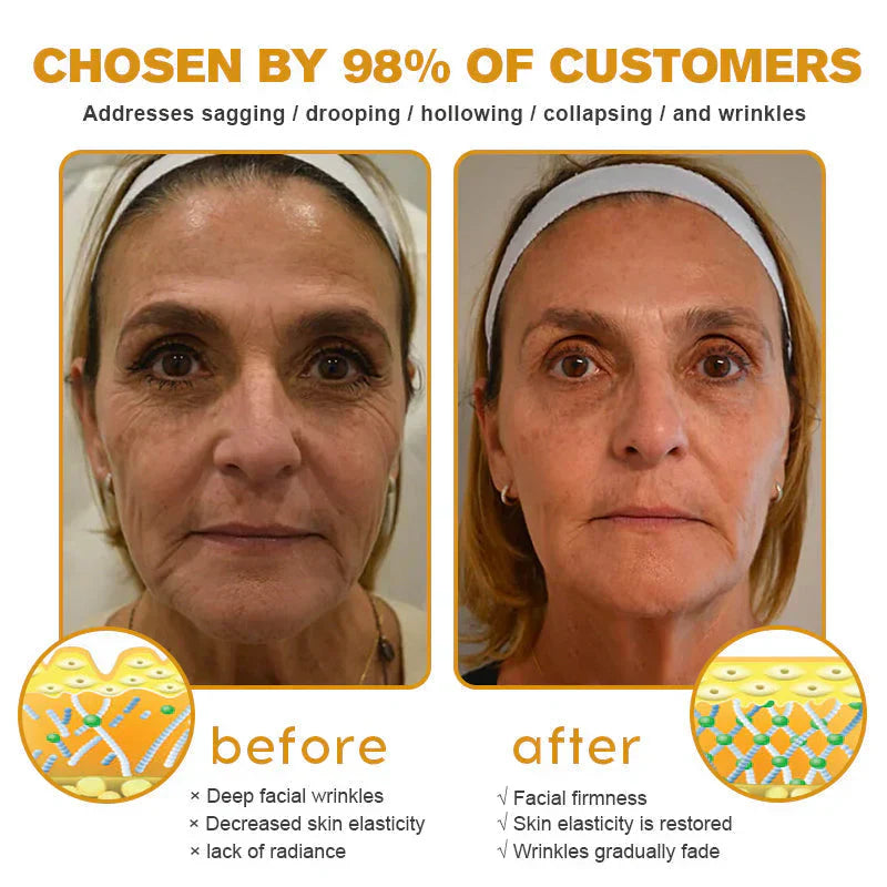 👨⚕️ Hergestellt und versendet in den DE ✅ Botox-Bienengift-Faltenentfernungscreme – LETZTER TAG 80 % RABATT