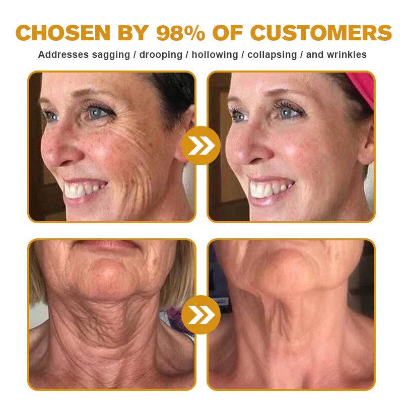 👨⚕️ Hergestellt und versendet in den DE ✅ Botox-Bienengift-Faltenentfernungscreme – LETZTER TAG 80 % RABATT